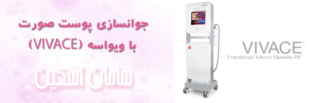 ویو
